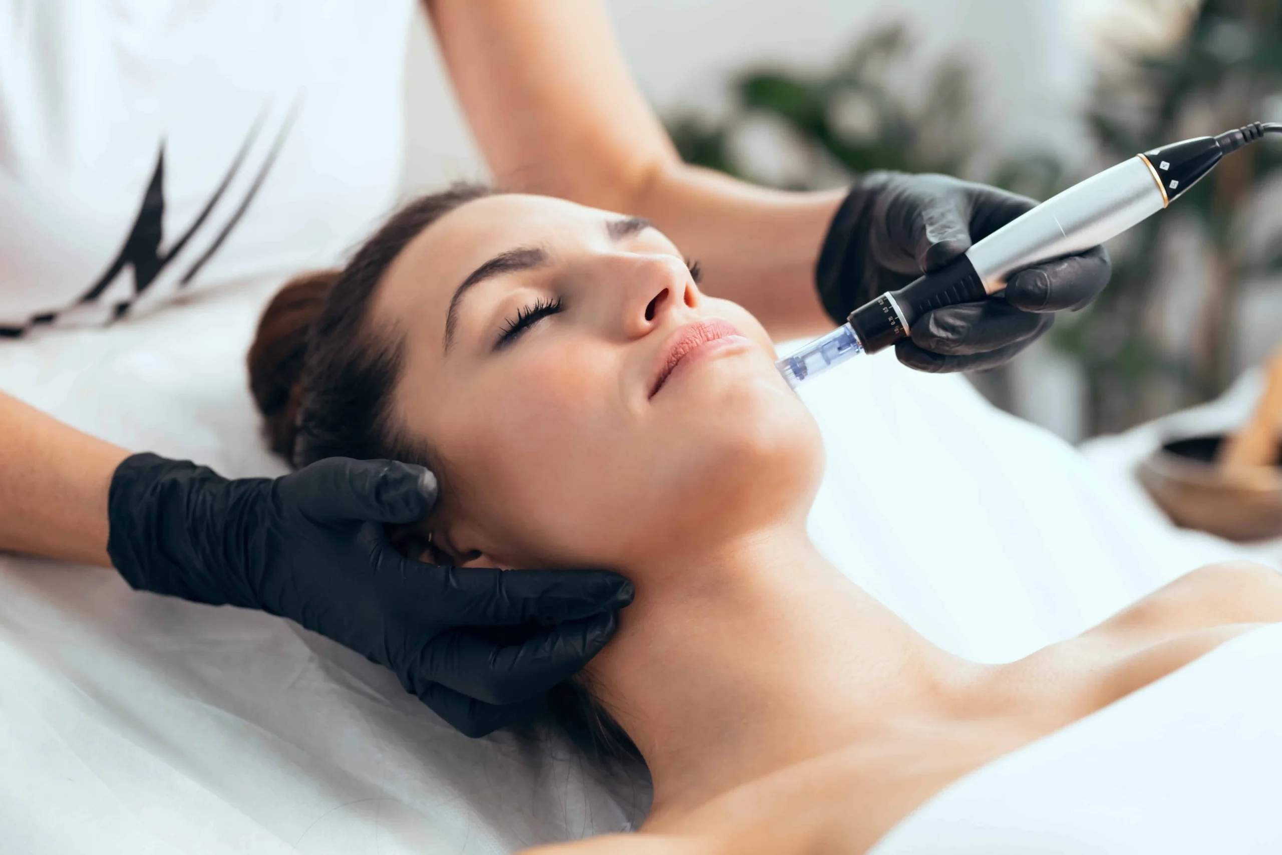 Microneedling with Exosomes Treatment | The Aesthetics Loft | Milford, CT