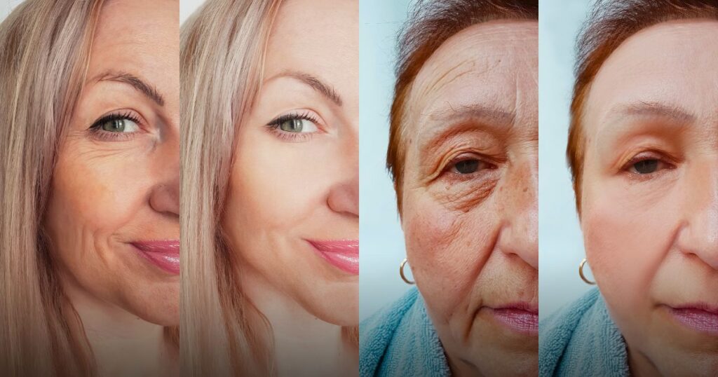 What to Expect After Botox Treatment