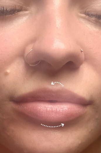 b1