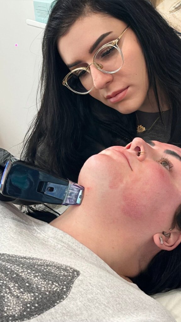 What Is Microneedling?