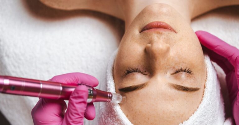 Microneedling Benefits