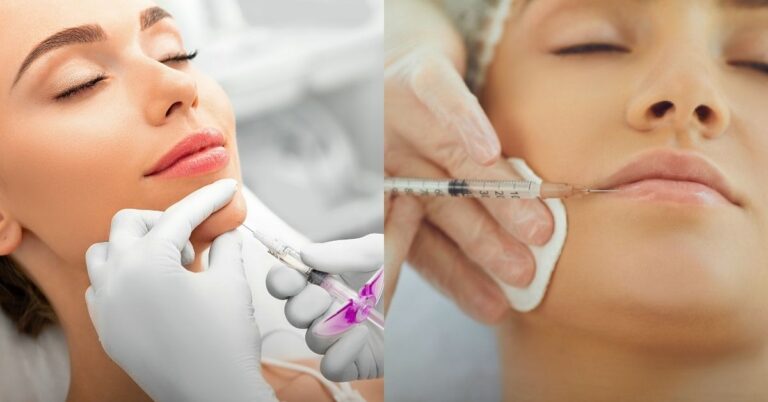 Essential Guide to Dermal Fillers and Lip Enhancements