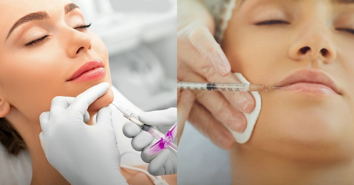 Essential Guide to Dermal Fillers and Lip Enhancements