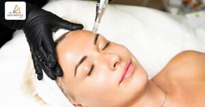 Microneedling Benefits What to Expect and How to Prepare
