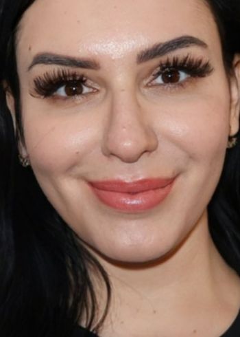 dermal fillers services in milford ct (1)